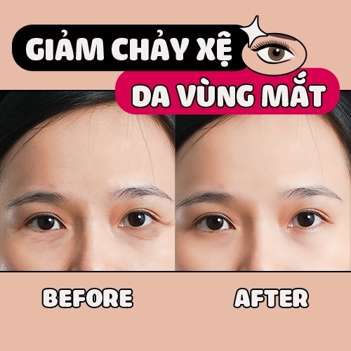 Tìm lại vẻ đẹp cho “cửa số tâm hồn” bằng bài tập giảm chảy xệ da vùng mắt