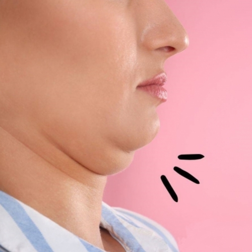 Mát-xa nọng cằm: Chỉ 3 phút mỗi ngày cho khuôn mặt thon gọn