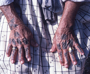 Hình xăm Hajichi mang ý nghĩa một người phụ nữ đã kết hôn. Ảnh: a-port.asahi.com