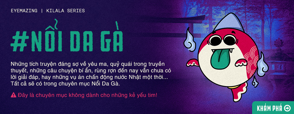 Nổi da gà