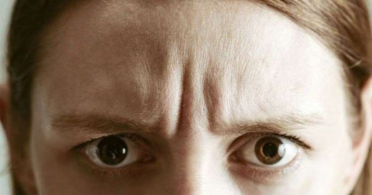 nếp nhăn giữa chân mày