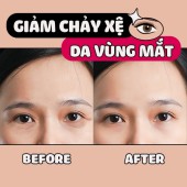 Tìm lại vẻ đẹp cho “cửa số tâm hồn” bằng bài tập giảm chảy xệ da vùng mắt