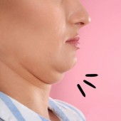 Mát-xa nọng cằm: Chỉ 3 phút mỗi ngày cho khuôn mặt thon gọn