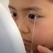 Giới trẻ Nhật chọn PTTM vì ám ảnh ngoại hình