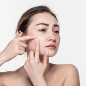 Chăm sóc da mụn đúng cách